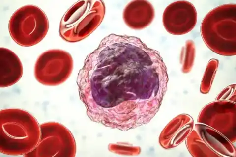 Brain Is Swollen: 7 Key Facts About Encephalitis, Symptoms, and Treatment