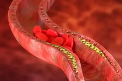 Liver Transplant