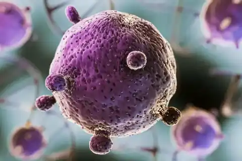 Kidney Stone Treatment