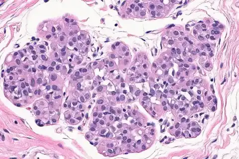 Top 10 Causes of Cancer: What Puts You Most at Risk?