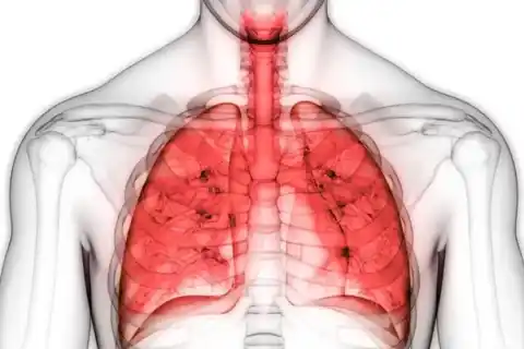 Diarrhea Underwear: What Patients Should Know