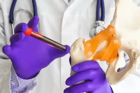 Loose Stool Not Diarrhea: What Patients Should Know