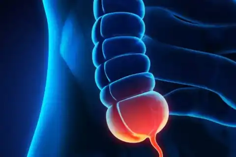 What Is Myelodysplastic Blood Disorder? Definition Explained