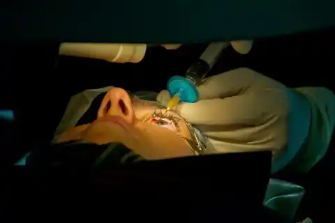 SMILE Laser Eye Surgery (ReLEx SMILE)