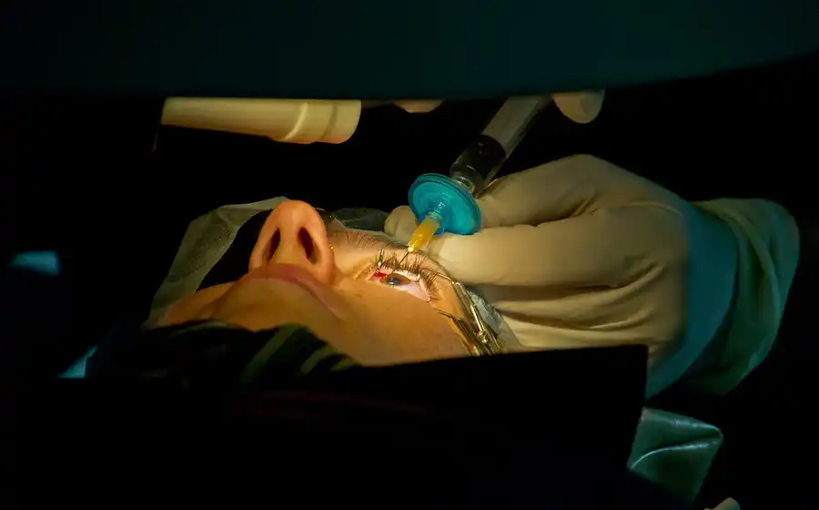 SMILE Laser Eye Surgery