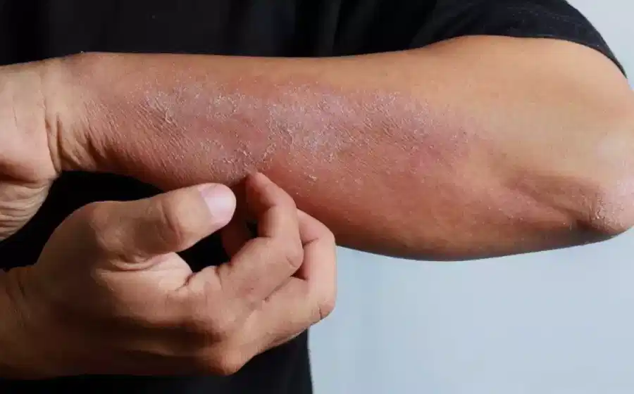 Medicana Sivas Hospital