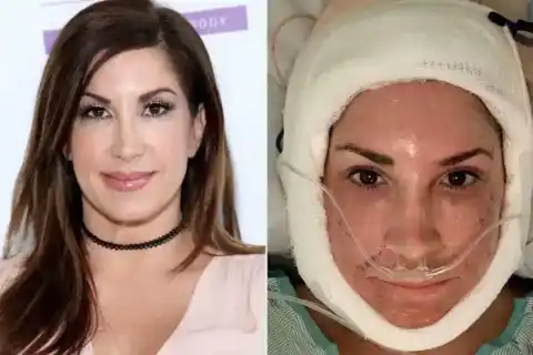 Fernando Bianco – plastic surgeon