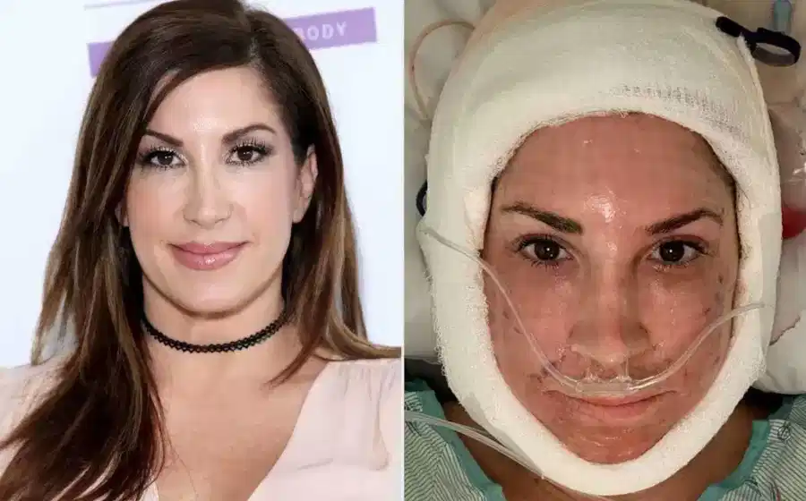 Fernando Bianco – plastic surgeon
