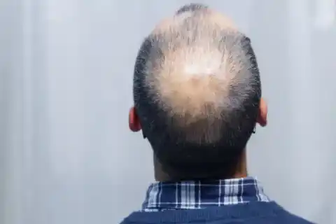 Skin Cancer Treatment