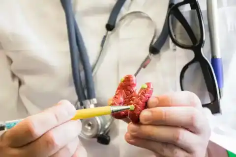 Dental Bridge