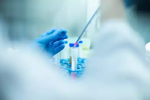 Labiaplasty
