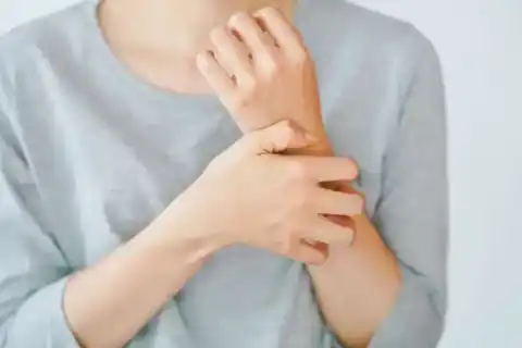 Keloid and Hypertrophic Scar Treatment