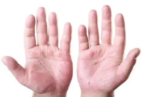 Foot Deformities