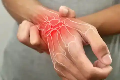 Soft Tissue Injuries