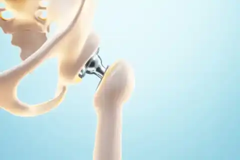 Cartilage Restoration