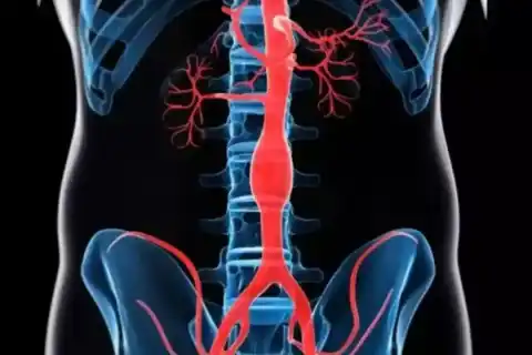 Coronary Angiography