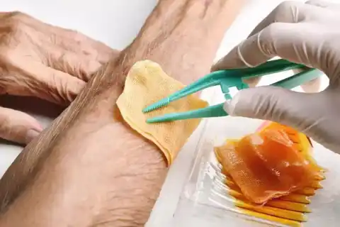 Mastoidectomy and Tympanomastoidectomy