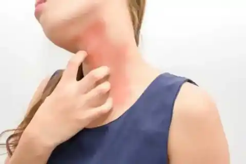 Neck Dissection