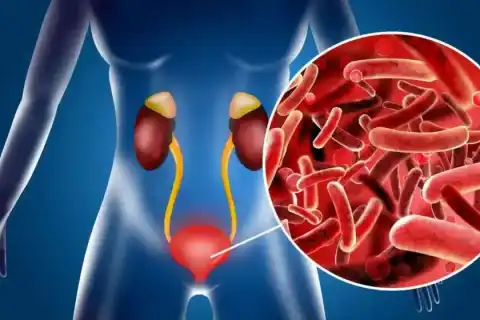 Neuromuscular Diseases