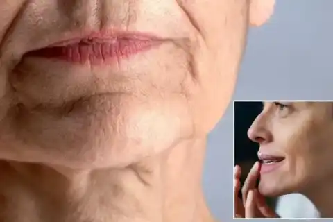 Stroke Medicine