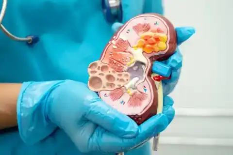 Diabetische Nephropathie