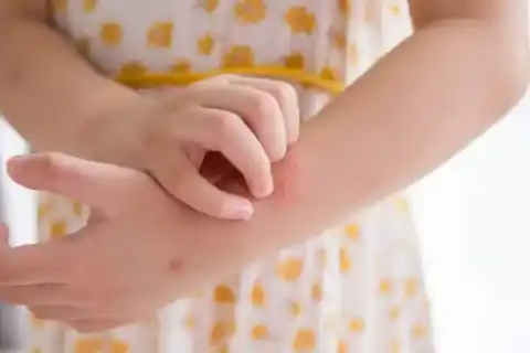 Uterine and Vaginal Prolapse