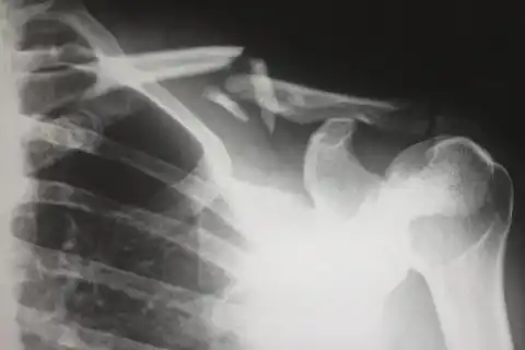 Clinic-Y xray 2