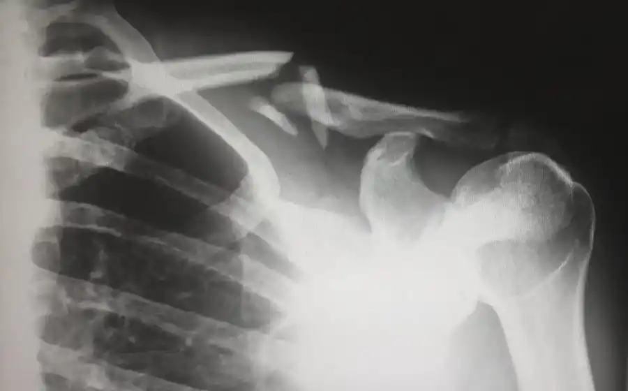 Clinic-Y Xray 2